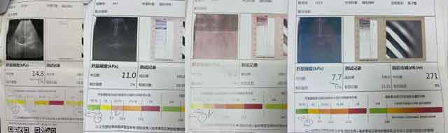 �������ί�Ч���õĸ�Ӳ���t(y��)Ժ?���ݸ�Ӳ����Ҏ(gu��)�t(y��)Ժ