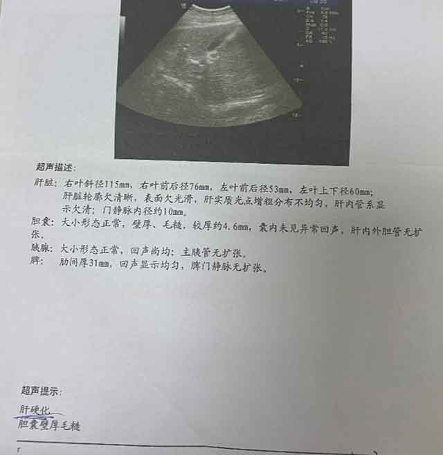 �������ί�Ч���õĸ�Ӳ���t(y��)Ժ?���ݸ�Ӳ����Ҏ(gu��)�t(y��)Ժ