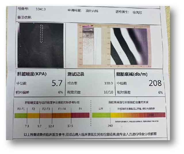 ���ݸβ��t(y��)Ժ�Ă����ձ��^��?�����ί��β��t(y��)Ժ