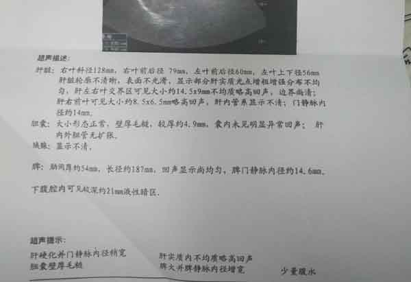 �]���X&ne;�]���},��ҕ�z�錧(d��o)�¸�Ӳ���İl(f��)��