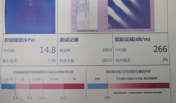 �]���X&ne;�]���},��ҕ�z�錧(d��o)�¸�Ӳ���İl(f��)��